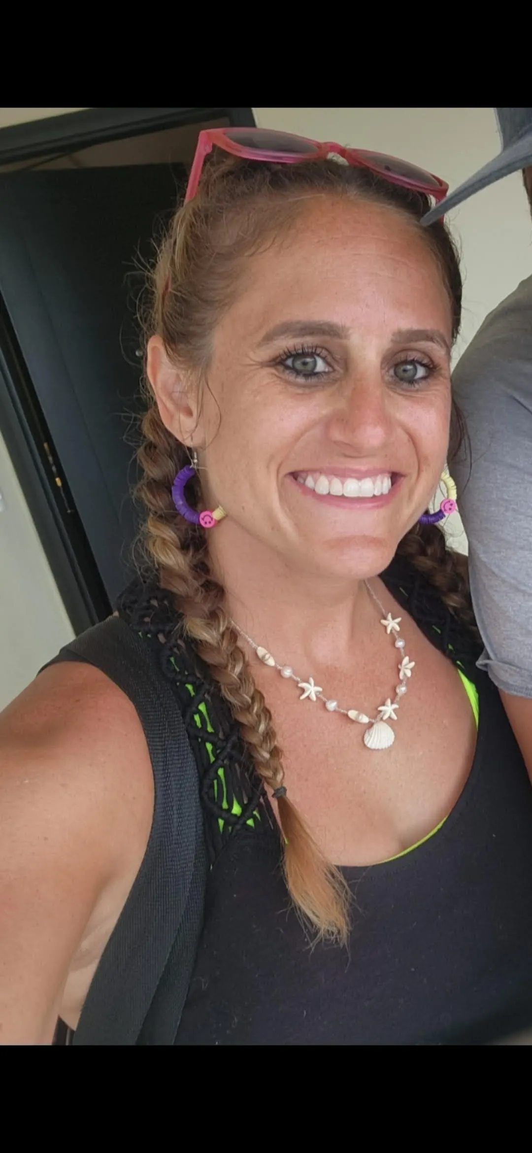 McKayla McCumber - Personal Endometriosis Story